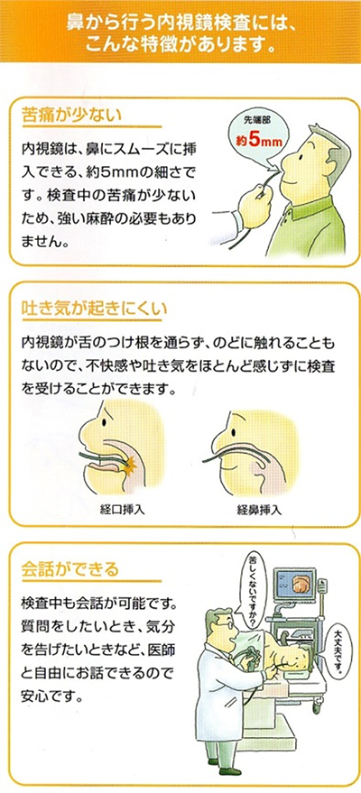 鼻から行う内視鏡検査の特徴